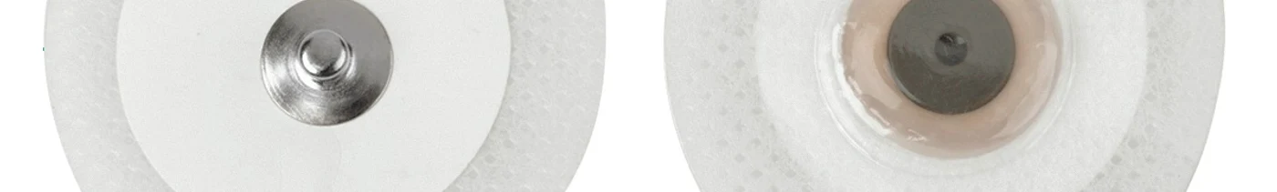 bed2e60e-f760-479c-a6c7-d146c0da5d57-slezaelktrodnetkan.jpg